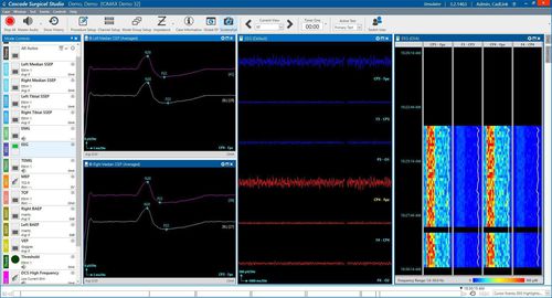 Datenverwaltungssoftware - Cascade® - Cadwell Industries - Reporting / Monitoring / Mess