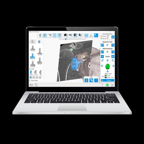 Chirurgisches Navigationssystem / zur Schulterpositionierung - Equinoxe®GPS® - Exactech - optisch