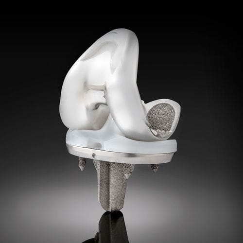 Femur-Patella Knieprothese - Truliant® Porous  - Exactech - mit mobiler Scheibe / zementfrei