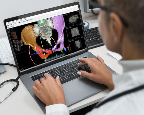Software / Präoperative Planung - OOOPDS - Taiwan Main Orthopaedic Biotechnology - Visualisierung / Simulation / 3D-Druck