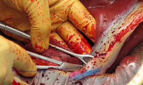 Näh-Patientensimulator - C-Celia   - Operative Experience Inc. - Notfall / Chirurgie / Geburtshilfe/Gynäkologie