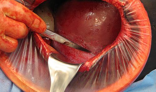 Patientensimulator für Entbindungen - C-Celia C-SECTION - Operative Experience Inc. - Notfall / Chirurgie / Geburtshilfe/Gynäkologie