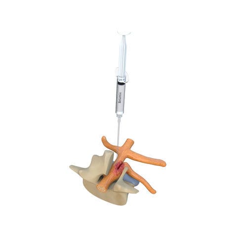Gel-Adhäsionsbarriere - BETAMIX - Betatech Medical - Abdominale Laparotomie / Laparotomie des Beckens / Kaiserschnitt