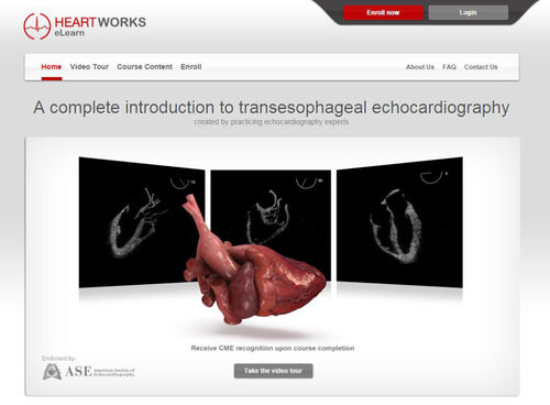 Ausbildungssoftware - Inventive Medical Limited - für Echokardiographie / webbasiert