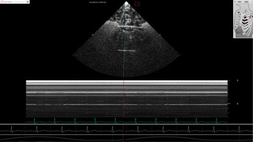 Software-Modul / für Echokardiographie - Pathology Module 6 - Inventive Medical Limited - Bewertung