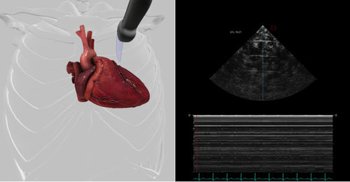 Software-Modul / für Echokardiographie - Pathology Module 7 - Inventive Medical Limited - Bewertung