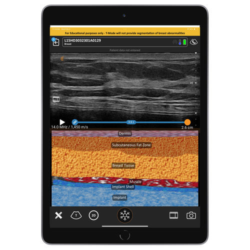 Software für Ultraschalluntersuchungen - T-Mode  - Clarius Mobile Health - Visualisierung / medizinisch