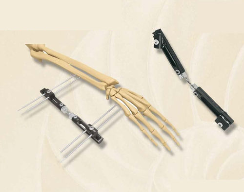 Fixateur externe / für Handgelenk - 406400 series - Biotech Medical - rohrförmig / für Erwachsene