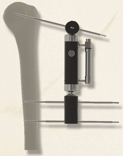 Fixateur externe / für Humerus - 40140030101 - Biotech Medical - rohrförmig / für Erwachsene