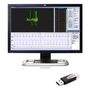 Software für EKG - iTengo+  - BORSAM Biomedical Instrument - für Krankenhaus / Reporting / Analyse