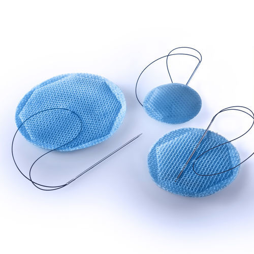Prothese für Nabelhernie - Intra-Swing® UMBI-LINK - SWING-TECHNOLOGIES