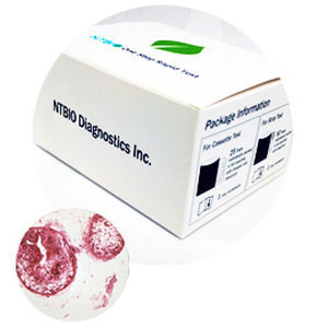 FOB-Schnelltest - N040 series - NTBIO Diagnostics - für Krebserkrankungen / Onkologie / Tumormarker