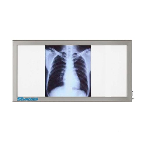 Röntgenfilmbetrachter / 3 Betrachtungsflächen - NT 130 - SCHRODER HEALTH PROJECTS - Weißlicht