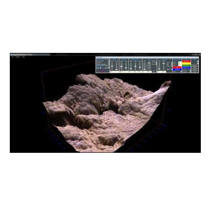 Medizinische Software - MiVim - Microptik BV - Bildanalyse / Mess / Schmelz