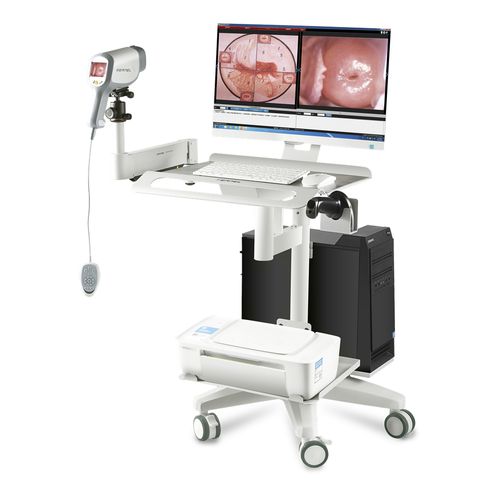 Videokolposkop - KN-2200I - Kernel Medical Equipment Co., Ltd - auf Wagen