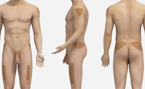 Simulationsmodul für intramuskuläre Injektion - SIMTICS - für Allgemeinpflege / webbasiert