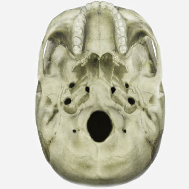 Simulationsmodul für Röntgenzwecke - SIMTICS - Anatomie / mit intrakraniellem Aneurysma / webbasiert