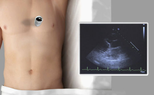 Simulationsmodul für Echokardiographie - SIMTICS - Anatomie / webbasiert