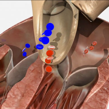 Simulationsmodul für Echokardiographie - SIMTICS - Anatomie / für Kllappenrekonstruktion / webbasiert
