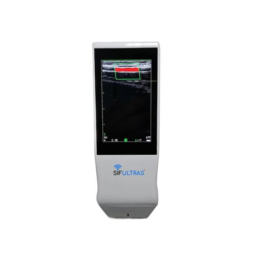 Ultraschall-Handgerät - SIFULTRAS-5.14 - SIFSOF - für Ultraschalldiagnostik in der Notfallmedizin / Schwarz-Weiß / Farbdoppler