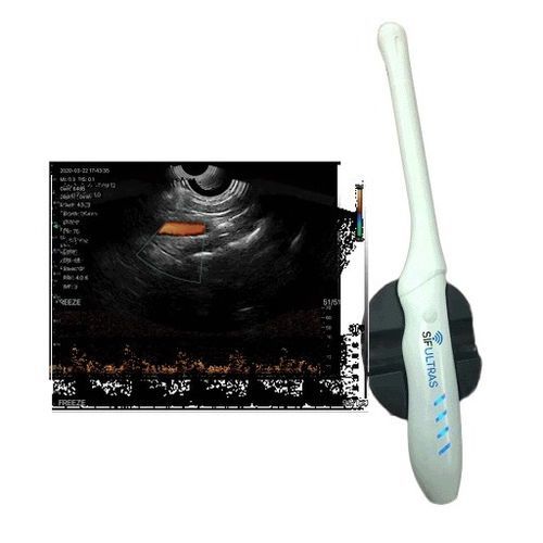 Tragbares Ultraschallgerät - SIFULTRAS-6.36 - SIFSOF - für transvaginale Ultraschalluntersuchung / Farbdoppler / Schwarz-Weiß