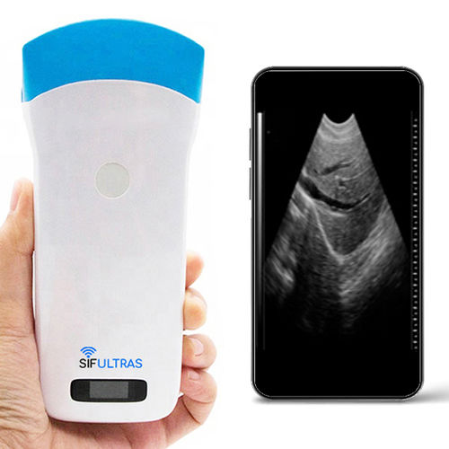 Ultraschall-Handgerät - SIFULTRAS-5.2 - SIFSOF - für Ultraschalldiagnostik in Gynäkologie und Geburtshilfe / für bildgebende Ultraschalldiagnostik im Bauch- und Beckenbereich / für Ultraschalldiagnostik in der Notfallmedizin