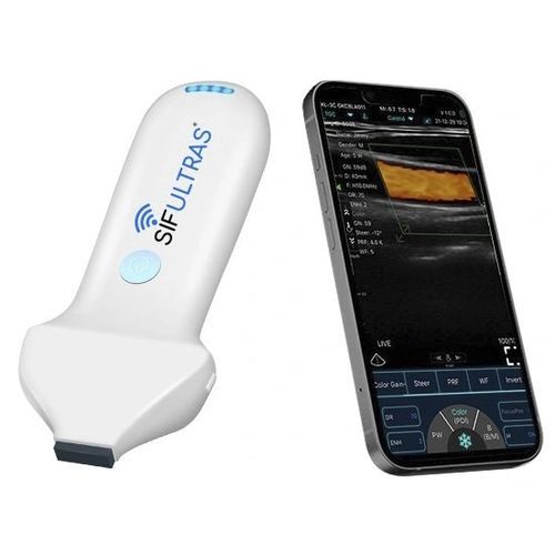 Ultraschall-Handgerät - SIFULTRAS-3.35 - SIFSOF - für kutane Ultraschalluntersuchung / Farbdoppler / Schwarz-Weiß