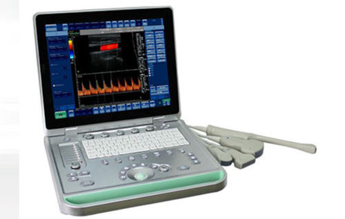 Tragbares Ultraschallgerät - SIFULTRAS-6.1 - SIFSOF - für Ultraschalldiagnostik in Gynäkologie und Geburtshilfe / für bildgebende Ultraschalldiagnostik im Bauch- und Beckenbereich / für urologische Diagnostik