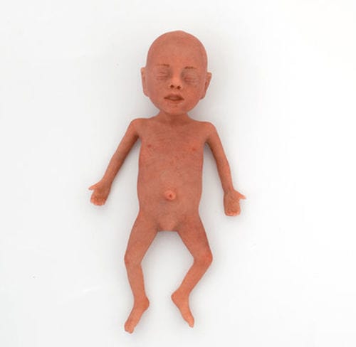 Trainingspuppe für pädiatrische Betreuung - NENASim Preemie - MEDICAL-X - für Reanimierung / für Neugeborene
