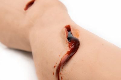 Trainingspuppe für Allgemeinpflege - MEDICAL-X - Traumazustände / Bein / Kunststoff