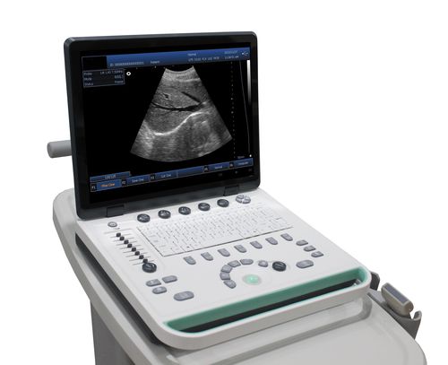 Ultraschallgerät / tragbar, mit Transportwagen - DP-50  - Promed Technology - für Ultraschalldiagnostik in Gynäkologie und Geburtshilfe / für bildgebende Ultraschalldiagnostik im Bauch- und Beckenbereich / für urologische Diagnostik