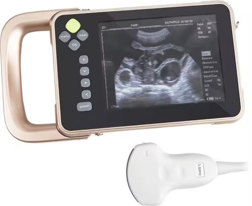 Tierärztliches Ultraschallsystem / Handgerät - V5 - Promed Technology - Multifunktion / für Kleintiere / für Großtiere