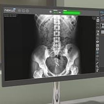 Bildanalyse-Software - Nexus DR  - VAREX Imaging - Beschaffung / medizinisch / Röntgen
