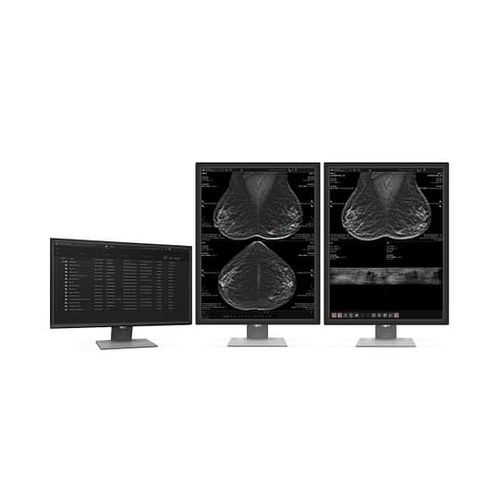 Medizinische Software - MammoScape™ - VAREX Imaging - Computertomographie / Röntgen / für Mammographie