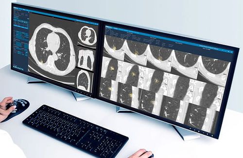 Bildanalyse-Software - Veolity - VAREX Imaging - Management / Reporting / CAD