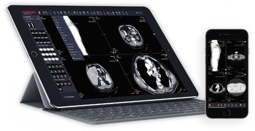 Web-Anwendung / Visualisierung - MedDream - SOFTNETA Medical Imaging - Viewer / Projektentwicklung / medizinisch