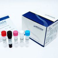Denguefieber-Testkit - GenoAmp&reg; GRA2006 - Medical Innovation Ventures - Viren / Serum / Plasma