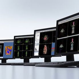 Visualisierungssoftware - DICOM RT Studio - PTW Freiburg Physikalisch-Technische-Werkstätten - Umform / für Strahlentherapie