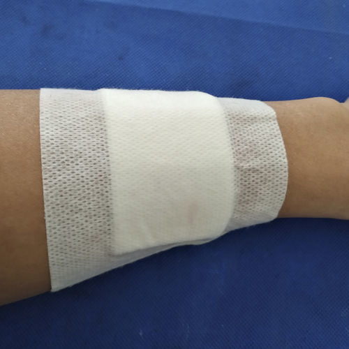 Antimikrobielle Mullkompresse - Hongkong Medi - bioresorbierbar / hämostatisch