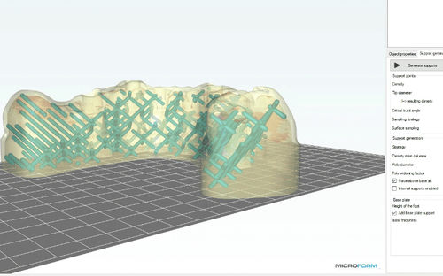 Dental-Software -  MicroForm® - Microlay - 3D-Visualisierung / Import / 3D-Druck