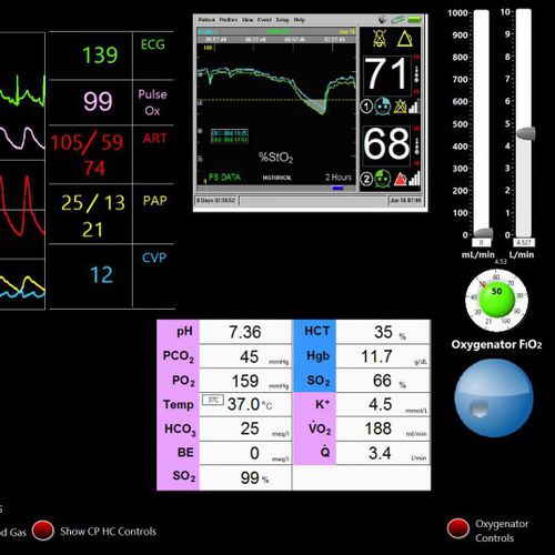 Simulator für kardiopulmonale Behandlung - Biomed Simulation Inc. - für die Herzchirurgie / Monitor / computergestützt