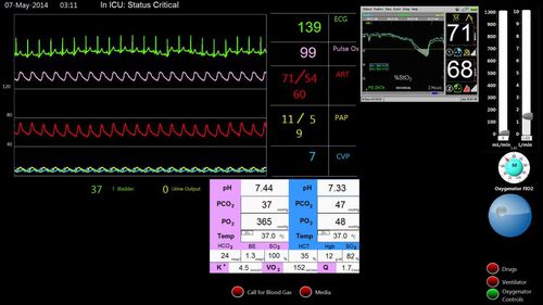 ECMO-Patientensimulator - Biomed Simulation Inc. - für kardiopulmonale Behandlung / Monitor / computergestützt