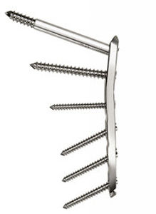 Kompressionsplatte für Oberschenkelknochen - Aconda  - Spinamer Health Products - für Trochanter / proximal / mit Verriegelung