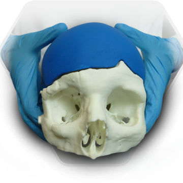 Patientenspezifisches Schädelimplantat - SkullPT  - 3D Side