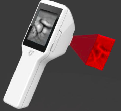 Infrarot-Venensucher - Veinus Pro - InfraEyes - Venenpunktion / Handgerät