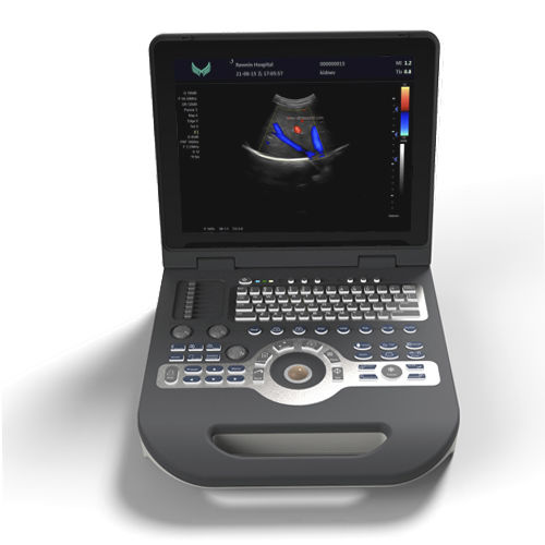 Tragbares Ultraschallgerät - XF3500 - Xianfeng Ultrasound Medical - für Multifunktions-Ultraschall / Schwarz-Weiß / Farbdoppler