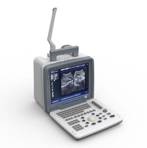 Tragbares Ultraschallgerät - XF300 - Xianfeng Ultrasound Medical - für Multifunktions-Ultraschall / Schwarz-Weiß / mit integrierter Konsole