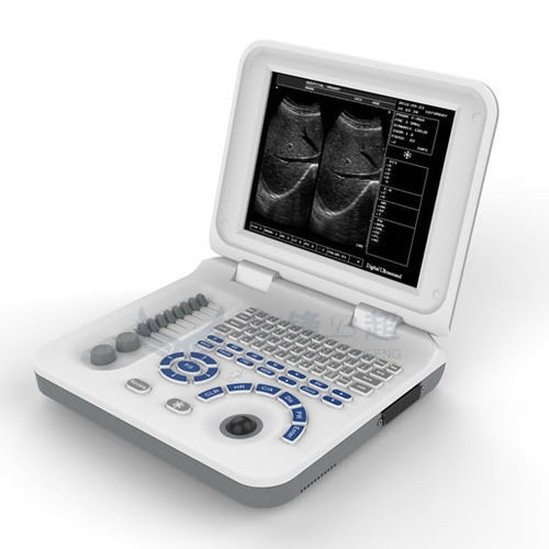 Tragbares Ultraschallgerät - XF30  - Xianfeng Ultrasound Medical - für Multifunktions-Ultraschall / Schwarz-Weiß / 10 "