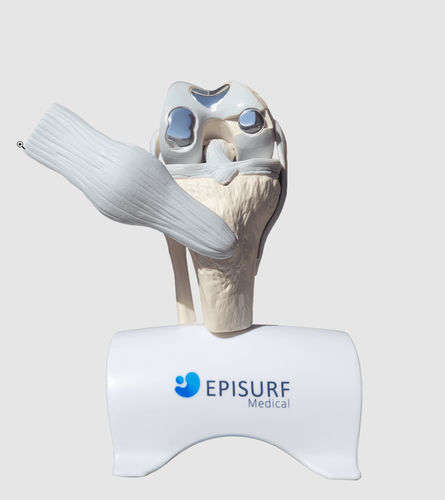 Implantat, ästhetisch / Knie - Episurf Medical - anatomisch / Aus Kobalt-Chrom