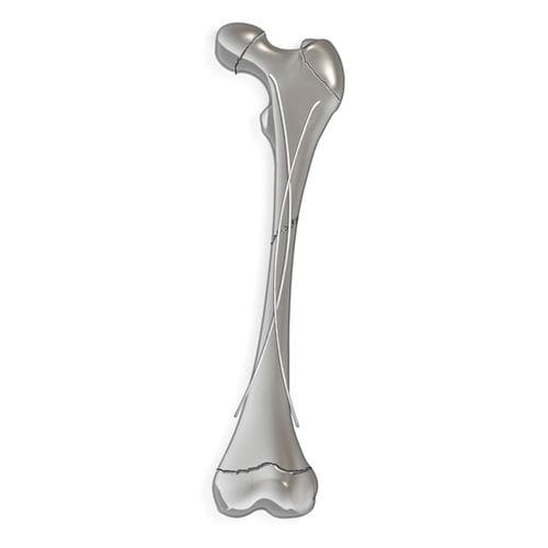 Marknagel für Oberschenkelknochen - pediFlex™ - OrthoPediatrics - für Tibia / für Fibula / für Humerus